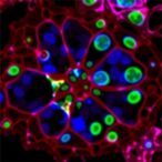 srebp1-knockdown-induces-ferroptosis-in-ovarian-cancer