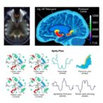 aptamer-proteomics-in-pediatric-severe-brain-injury