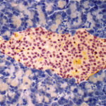 electronic-mesh-spurs-islet-cell-maturation,-could-aid-diabetes-care