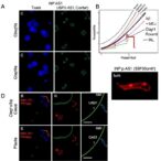 usp30-as1:-a-dual-localized-lncrna-fueling-breast-cancer-growth-by-coordinating-p21-suppression