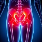 hip-fracture-surgery-outcomes-in-nonagenarians-explored