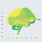 new-nomogram-predicts-cognitive-frailty-in-elderly-heart-patients