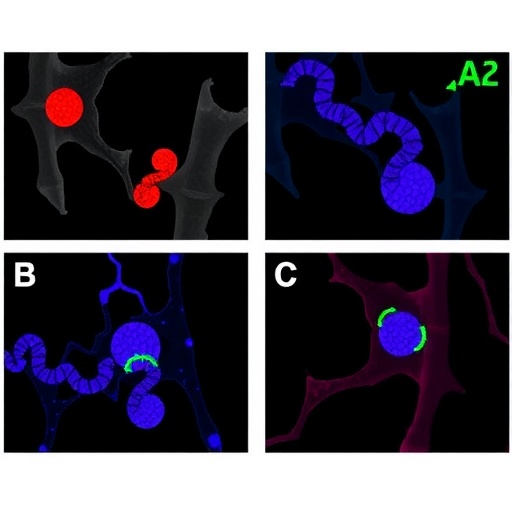ephrin-a1–epha2-signaling:-new-fracture-prevention-target