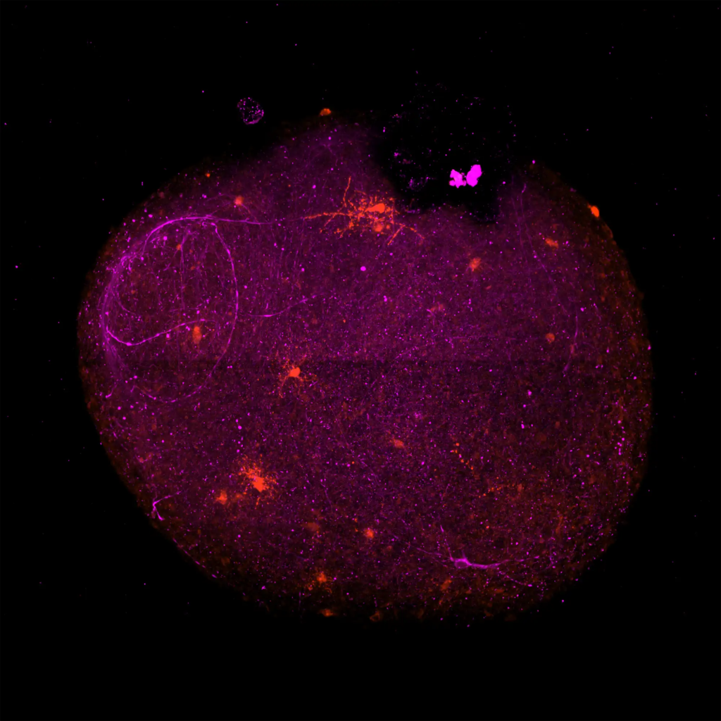 assessing-myelin-formation-and-therapeutic-response-using-3d-organoids