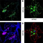 pdha1-boosts-ferroptosis-resistance-via-aifm2-upregulation
