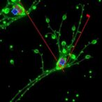 assessing-biological-activity-using-biospeckle-laser-imaging