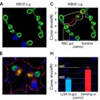 ash2l-drives-tamoxifen-resistance-via-itga6/erk