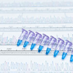 beam-designs-new-approach-for-direct-correction-of-mutations-causing-pku