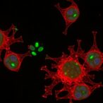 axin1-protects-cone-cells-by-inhibiting-gsk3β