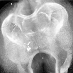 precise-locations-of-oligodendrocytes,-myelin-density-mapped-across-mouse-lifespan