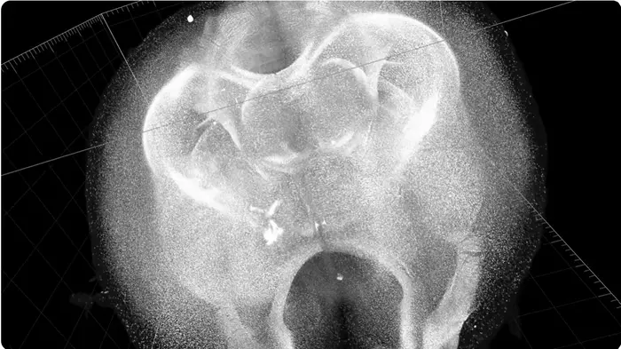 precise-locations-of-oligodendrocytes,-myelin-density-mapped-across-mouse-lifespan