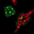 sel1l-hrd1-erad-boosts-glucagon-in-islet-α-cells