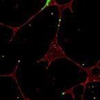 osteocytic-lipocalin-2-controls-bone-formation-via-ferroptosis