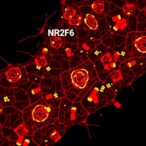 nr2f6-deletion-boosts-car-t,-sparks-tumor-immunity