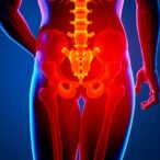 add-on-self-care-boosts-recovery-in-hip-surgery