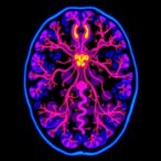 diagnostic-transcriptome-sequencing-of-1233-tumor-samples