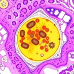 biases-challenge-molecular-biomarker-predictions-in-histology