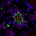 cd44-lactylation-weakens-cd8+-t-cells-in-kras-cancer