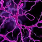 glucocorticoid-fas-axis-drives-metastatic-immune-evasion