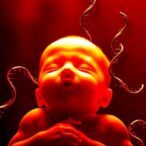 bilirubin,-phototherapy,-and-genes:-untangling-their-impact