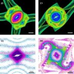 mapping-joint-tissue-mechanics-with-speckle-rheology