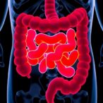 new-study-aims-to-enhance-communication-of-genetic-risks-in-colorectal-cancer