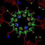 unraveling-pfdnmt2-and-pfatp6-roles-in-malaria-drug-resistance
