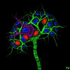 wwp1-activates-tgfβ-to-trigger-neurodevelopmental-anoikis