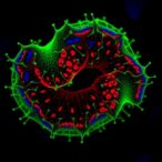 lrrk2-boosts-microglial-gcase-activity-via-ifnγ