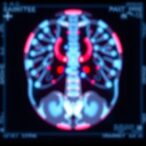 exploring-ai’s-potential-to-enhance-radiology-workflows-and-transform-healthcare-delivery