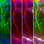 degenerating-tanycytes-disrupt-tau-removal,-shaping-alzheimer’s-progression