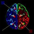 unraveling-cell-specific-tdp-43-pathology-in-motor-cortex