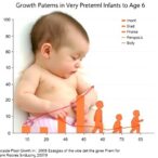 growth-patterns-in-very-preterm-infants-to-age-6