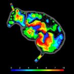 spatial-transcriptomics-maps-raav-liver-transduction-patterns