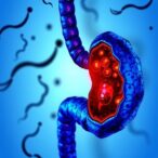 new-strategy-halts-pancreatic-cancer-by-targeting-microscopic-lesions-before-tumor-development