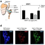 nrip1-blocks-erα,-causes-salivary-dysfunction-in-sjogren’s