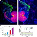 glis3-controls-pkm2-in-polycystic-kidney-metabolism