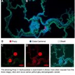 blocking-prolyl-3-hydroxylase-1-slows-pancreatic-cancer