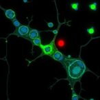 single-cell-study-reveals-immune-crosstalk-in-lichen-planus