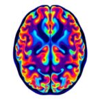 neuroimaging-reveals-microstructural-brain-changes-in-parkinson’s