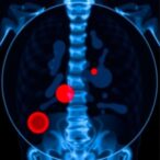 early-scans-may-save-lives-of-emergency-patients-presenting-with-blood-in-urine