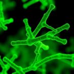 non-antibiotic-selection-boosts-imaging-of-resistant-bacteria