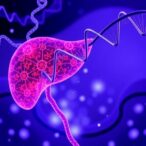 epigenetics-guides-nf-κb-signaling-in-pancreatic-cancer