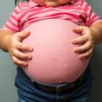 study-finds-childhood-obesity-hinders-economic-advancement-later-in-life