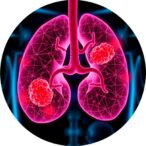 researchers-supercharge-immune-cells-to-target-prostate-cancer