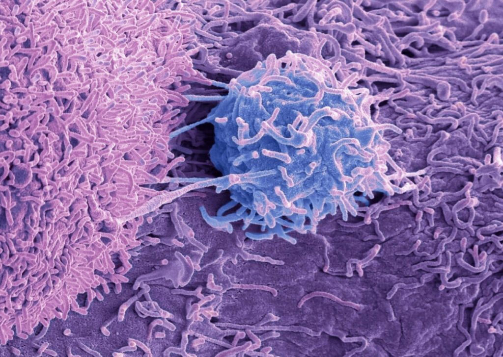 modifying-t-cell-receptor-improves-targeted-cancer-therapy 