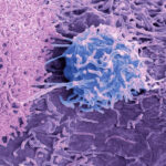 modifying-t-cell-receptor-improves-targeted-cancer-therapy 