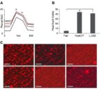 hsp47-in-fat-tissue-drives-diet-induced-inflammation
