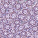 lazyslide:-open-framework-for-integrating-whole-slide-and-molecular-data