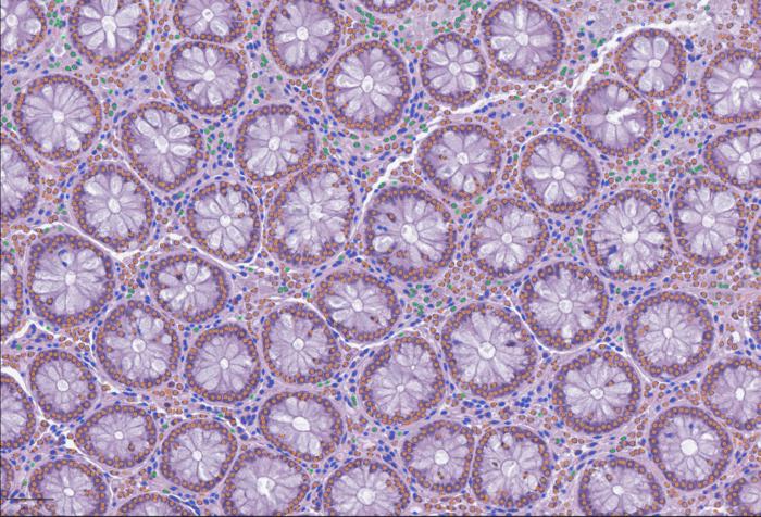 lazyslide:-open-framework-for-integrating-whole-slide-and-molecular-data